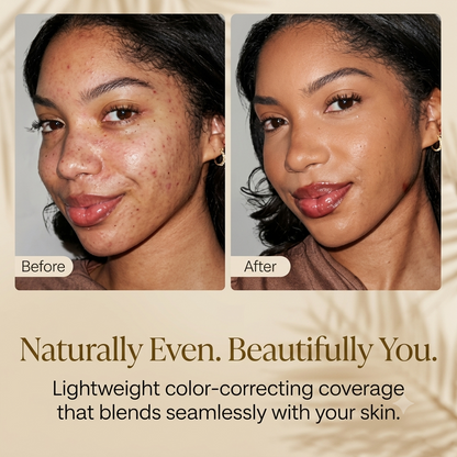 Revéra™ SkinMatch Serum