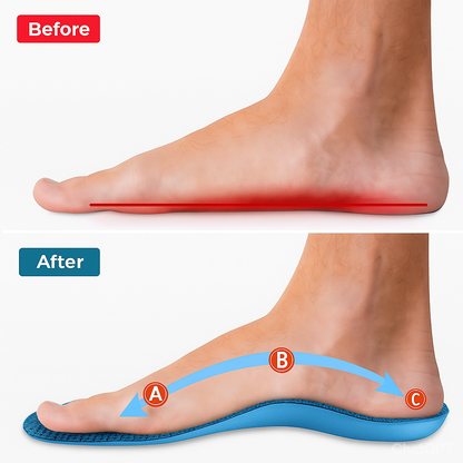 Revéra™ Plantar Fasciitis Insoles